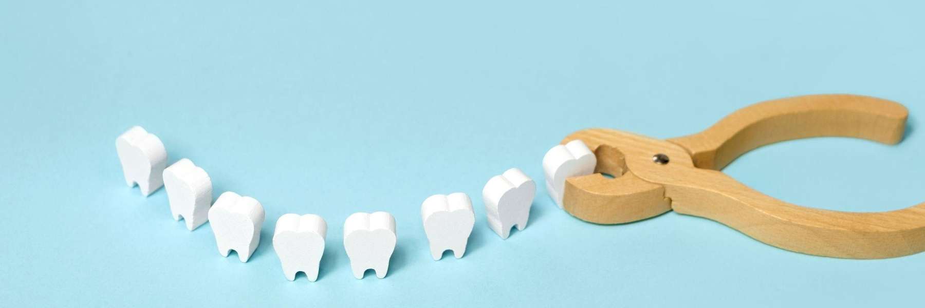 wisdom teeth removal